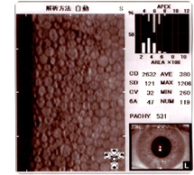 角膜内皮細胞検査