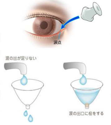 画像alt